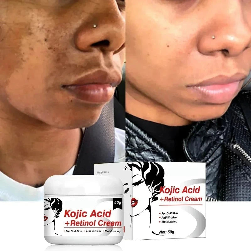 Kojic Acid Retinol Cream