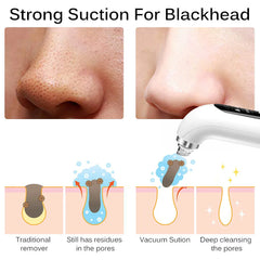 Blackhead Remover Vacuum